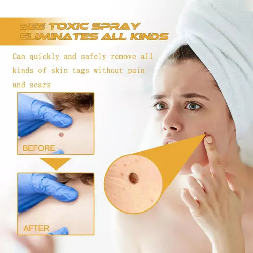 Tag Recede Spray Eliminador de Verrugas