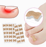 Corrector de Uñas encarnadas - Super Ofertas