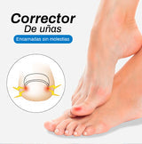 Corrector de Uñas encarnadas - Super Ofertas