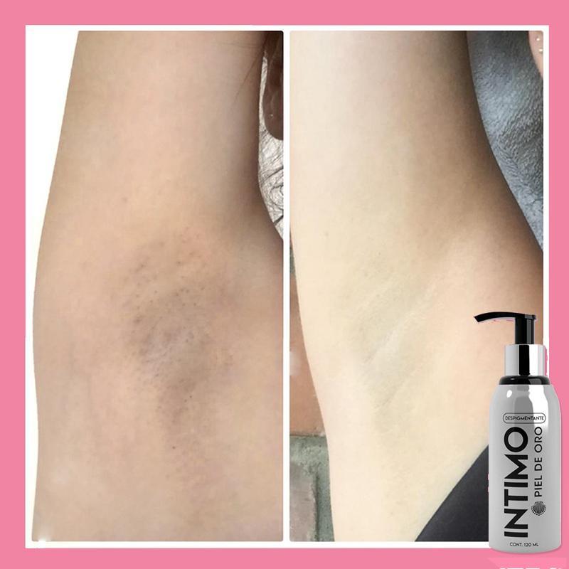 Despigmentante Intimo - Super Ofertas