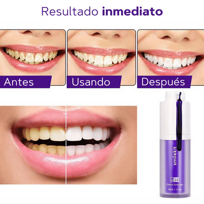 Smilekit espuma morada blanqueadora