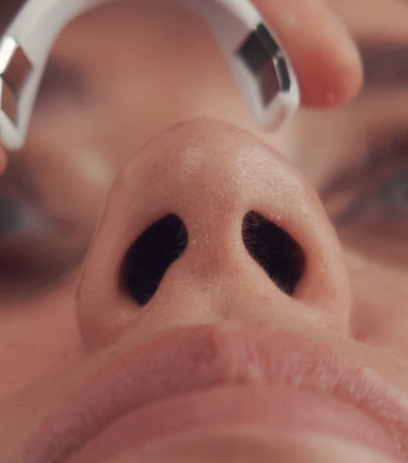 Dilatador Nasal Magnetico